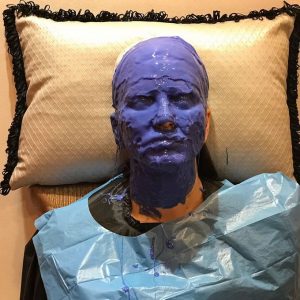 Sunny Leone made a surgery to change the complete face