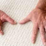 successful, Transplant, of, foot fingers, in, a, hand
