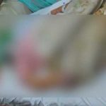 LAHORE: Young throws acid on his fiance, the girl moves to the hospital
