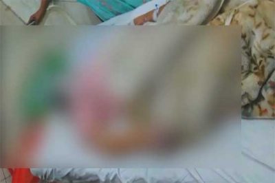 LAHORE: Young throws acid on his fiance, the girl moves to the hospital