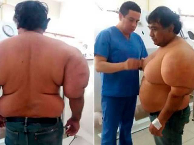 پیرو میں بلبلہ آدمی نے دنیا کو حیرت زدہ کردیا