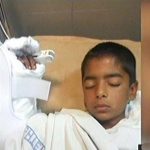 Multan government doctors paired baby wrist arm