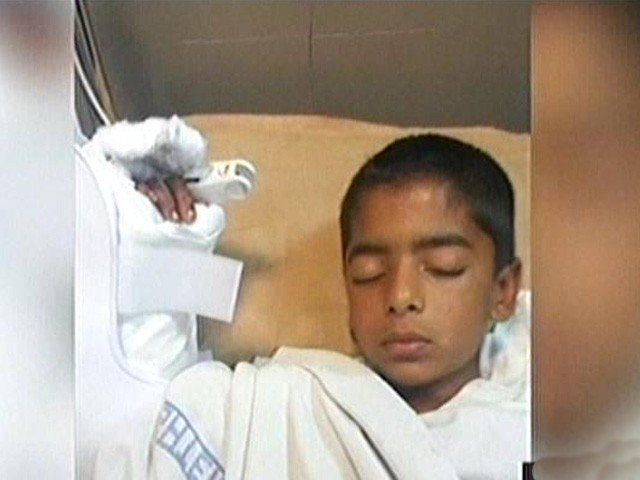 Multan government doctors paired baby wrist arm