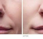 Why, the, line, under, the, nose, appear, in, all, human