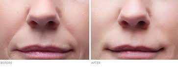 Why, the, line, under, the, nose, appear, in, all, human