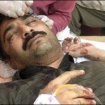 Senior reporter's private reporter injured in an attack of unknown people