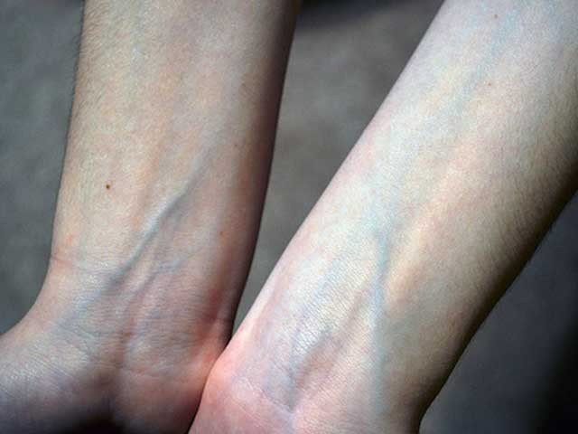 Human, body, vein,