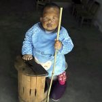 Due to mysterious illness, a 30-year-old man appeared to be a 3-year-old boy