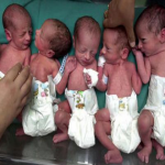 Birth of 6 childrens at time of women in Saudi Arabia