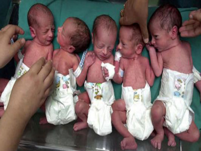 Birth of 6 childrens at time of women in Saudi Arabia