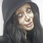 The beauty girl ruined her attitude to becoming Angelina Jolie