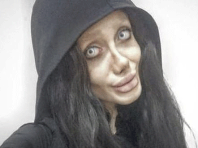 The beauty girl ruined her attitude to becoming Angelina Jolie