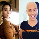 Bald nurse became model in Sweden