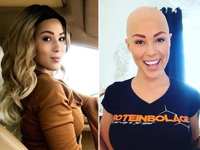 Bald nurse became model in Sweden