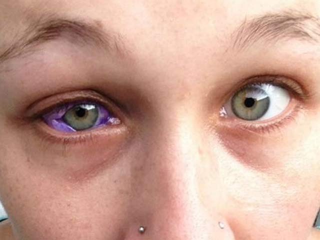 Canada's model was expensive to make tattoo on eye