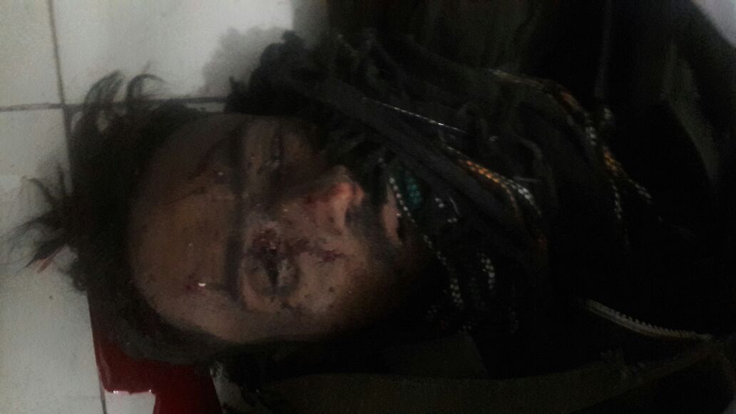 baluchistan, blast, near, Baluchistan, provincial, assembly, and, Zargoon, Road, 6, injured