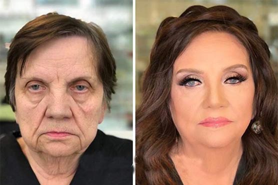 Being young now for old women is possible in the moments