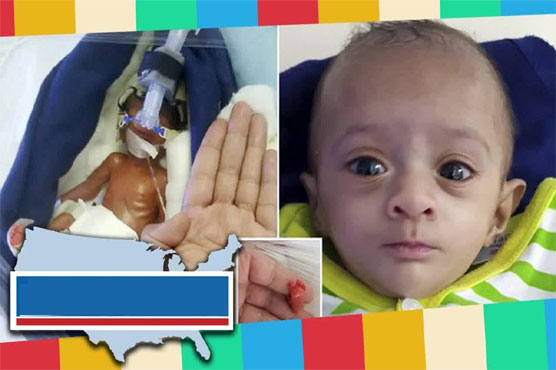 The baby whose to avoid was declared impossible