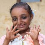 18-year-old girl in India height only two feet 9 inches and habbits like 4-year-old girl