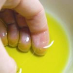 Inflict mustard oil on the nails get rid of 6 acne diseases
