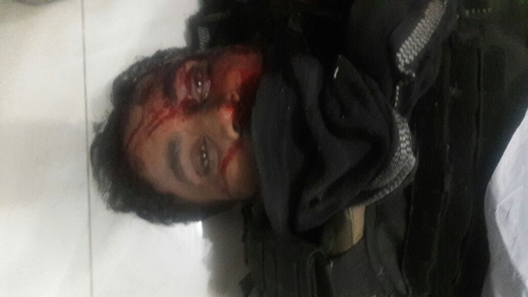 baluchistan, blast, near, Baluchistan, provincial, assembly, and, Zargoon, Road, 6, injured