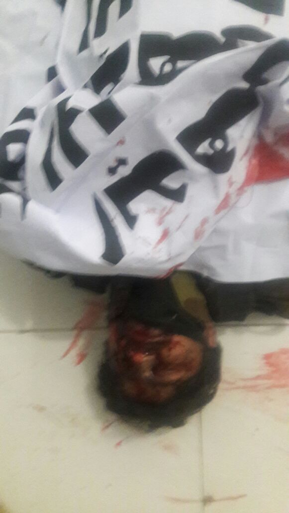 baluchistan, blast, near, Baluchistan, provincial, assembly, and, Zargoon, Road, 6, injured