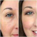 Get out of color and avoid black circles