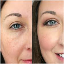 Get out of color and avoid black circles