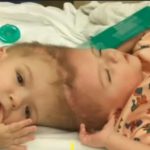 Widow mother appeal for help from high officials for operation of birth twins babies