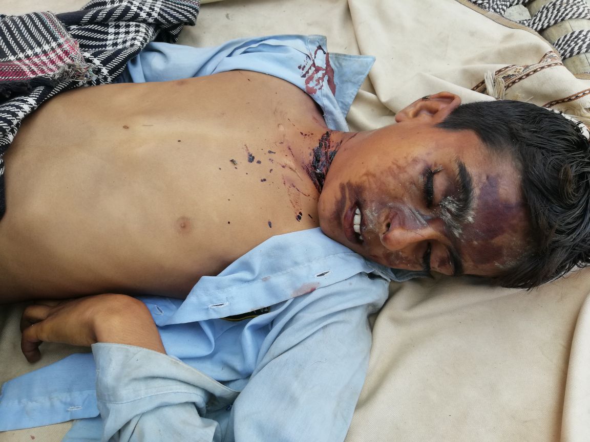 PAKPATAN, SEVEN, YEARS, OLD, STUDENT, KILLED, WITH, SHARP, INSTRUMENT