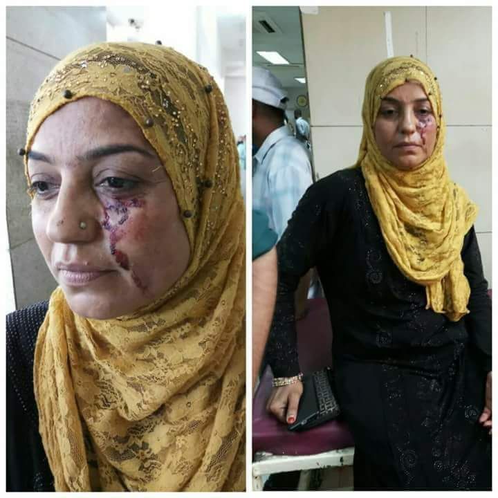 This is the women's party PPP Karachi Khatin Wing President Saira Baloch, who today visited his area, unknown people were tortured and fled from the spot. We strongly condemn this fascinating act on a woman and appeal to her leadership that people involved in this murderous act should immediately be punished and all party workers should be protected so that they fear Bhattu Could test it