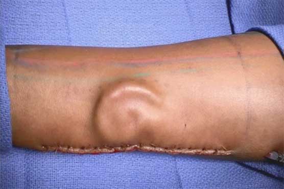 Female soldier was shifted to the arm