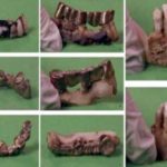 Scientists found Hitler's teeth