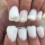 Unique nails prepare for peoples who clutter the nails