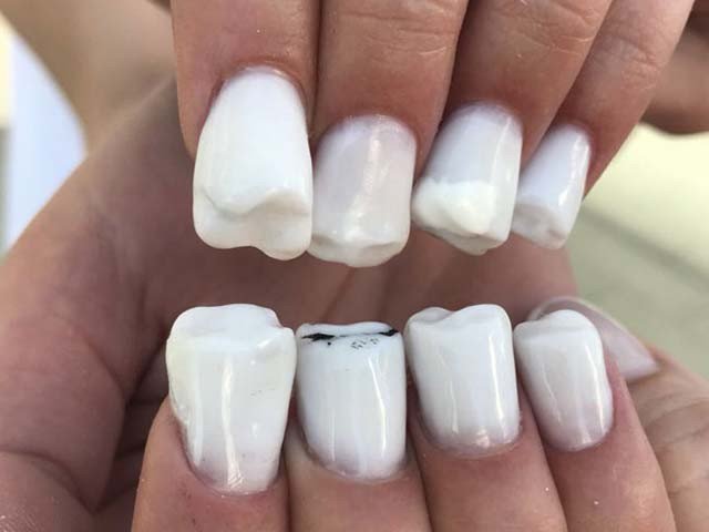 Unique nails prepare for peoples who clutter the nails