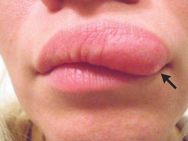 The lady's face shaped inside the face