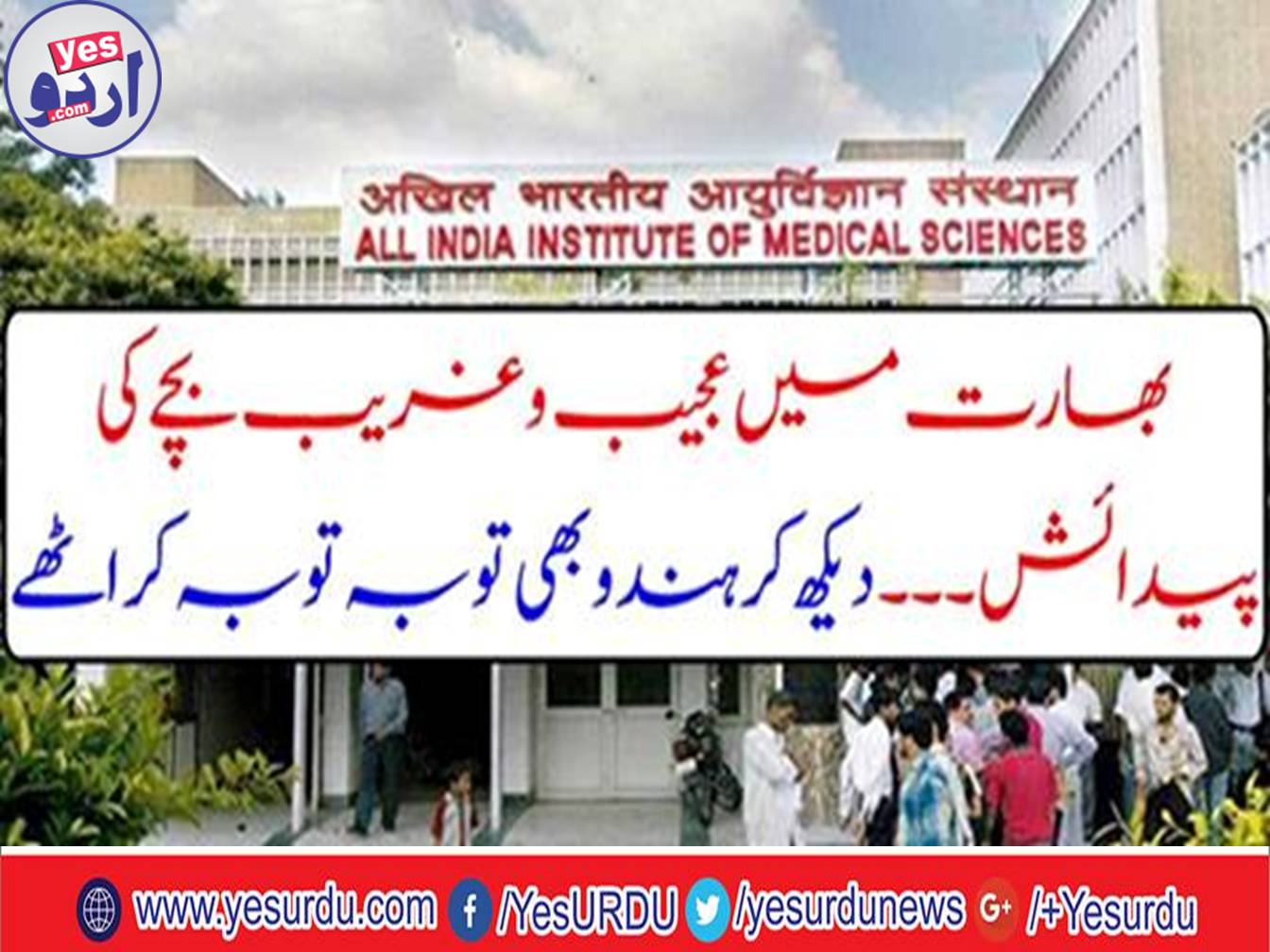 The child born with teeth in India surprised everyone including doctors