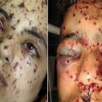 UN: Proposes to make commission on human rights violations in occupied Kashmir