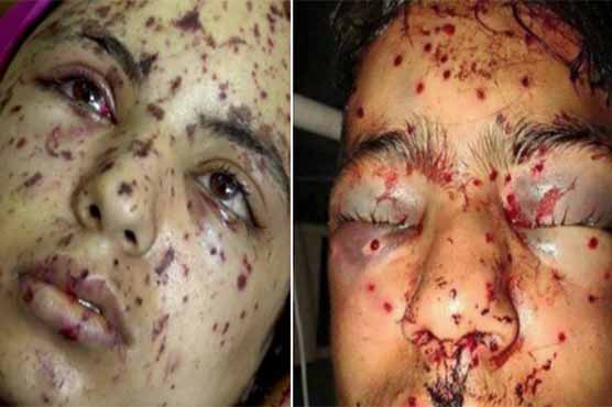 UN: Proposes to make commission on human rights violations in occupied Kashmir