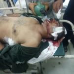 Pindigheb, Two motorcycles conflict on basal road, motorcycle riding seriously injured