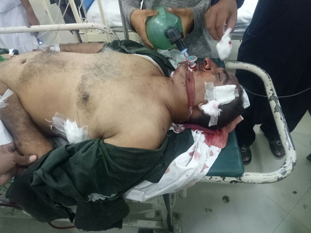 Pindigheb, Two motorcycles conflict on basal road, motorcycle riding seriously injured