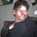 Youngster got hit by train during crossing the train strip, shifted to the hospital in the condition of severe injured