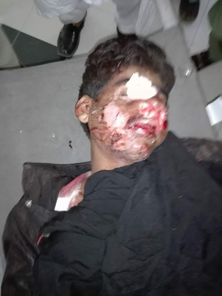 Youngster got hit by train during crossing the train strip, shifted to the hospital in the condition of severe injured