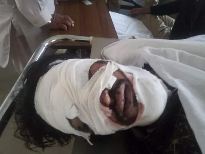 Jehlum: Young traveling on the railway car collapsed from the train during switching selfie