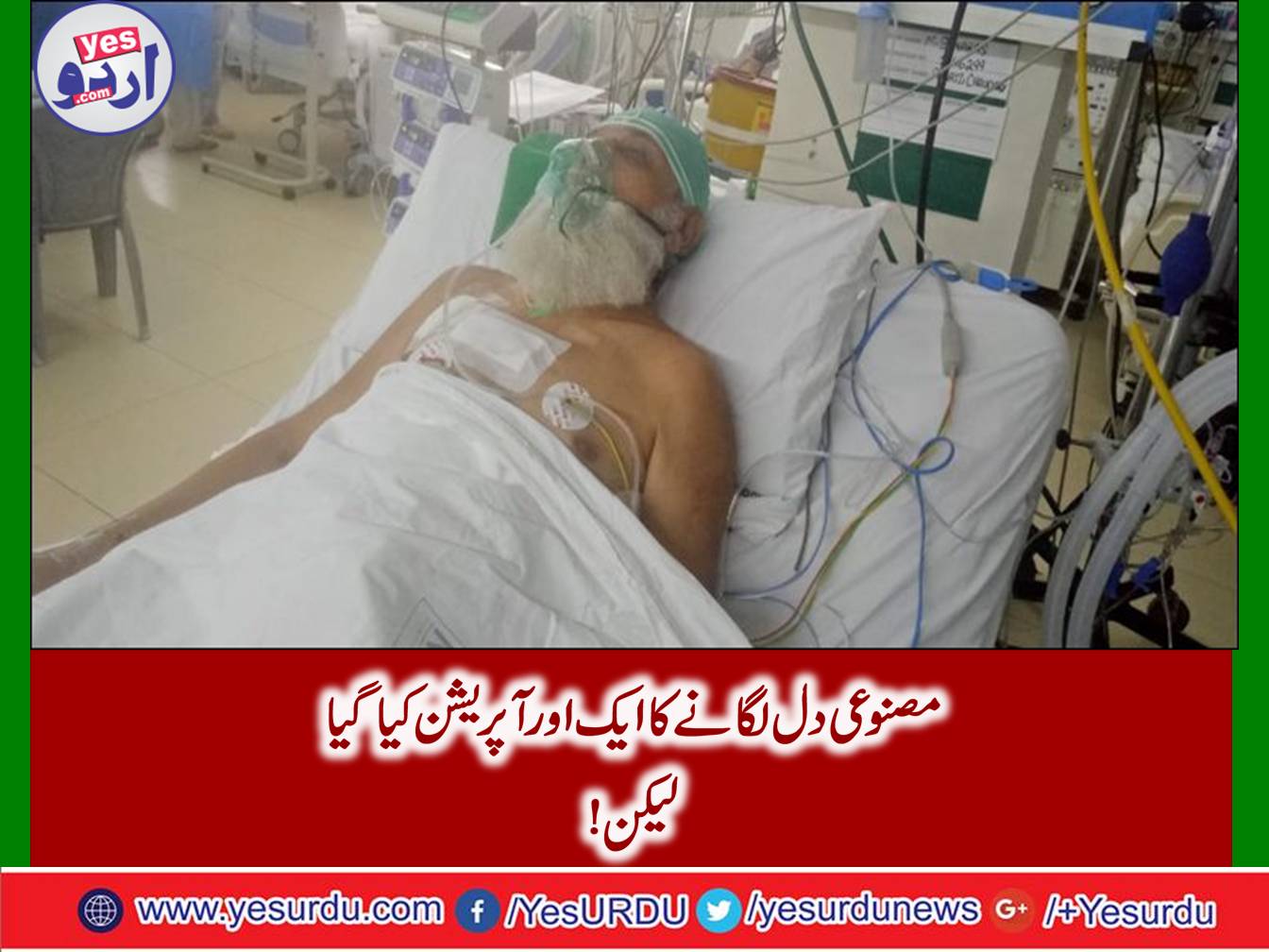 Another successful operation of artificial laid heart