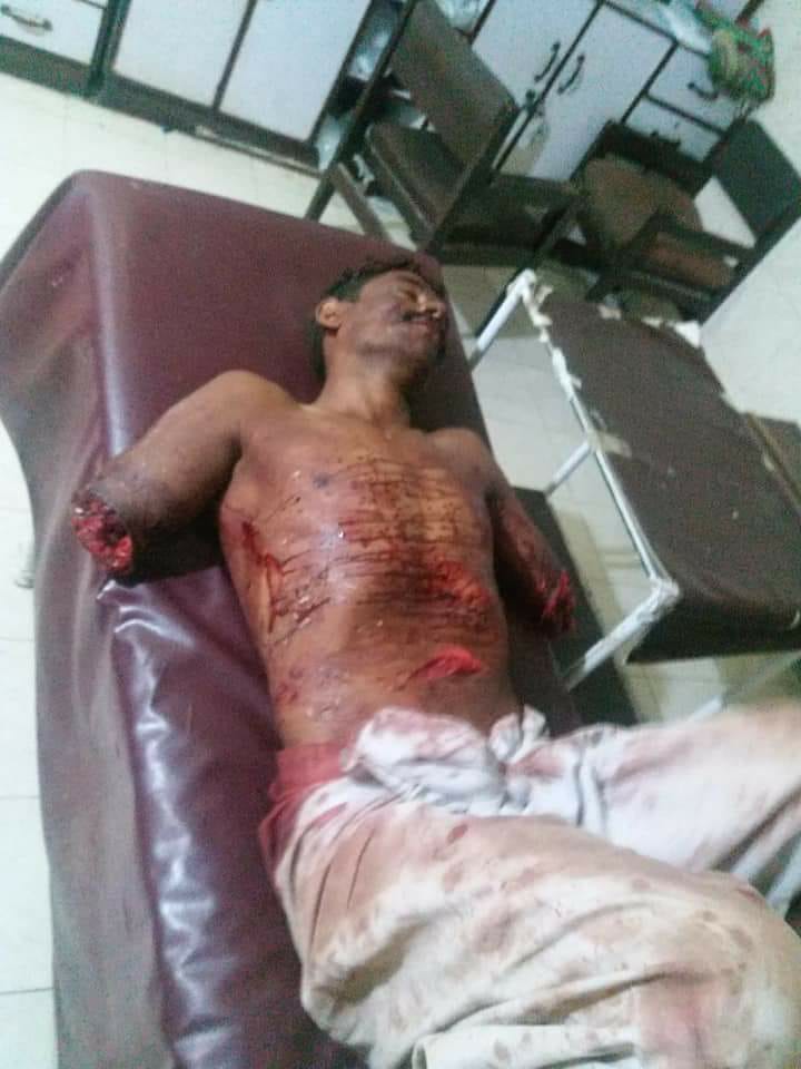 bellan,cruel,man,cut,his,wife,and,guest's, arms, and, toungue