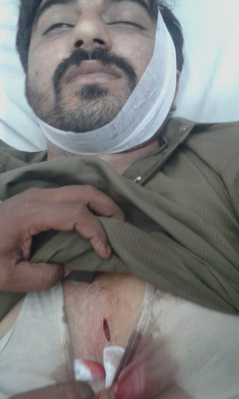 A minor bitter word in the Tench bhatta to drove a person to death