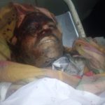 The rickshaw driver Shah Khan jan killed was murdered from two unknown persons firing, hospital moved