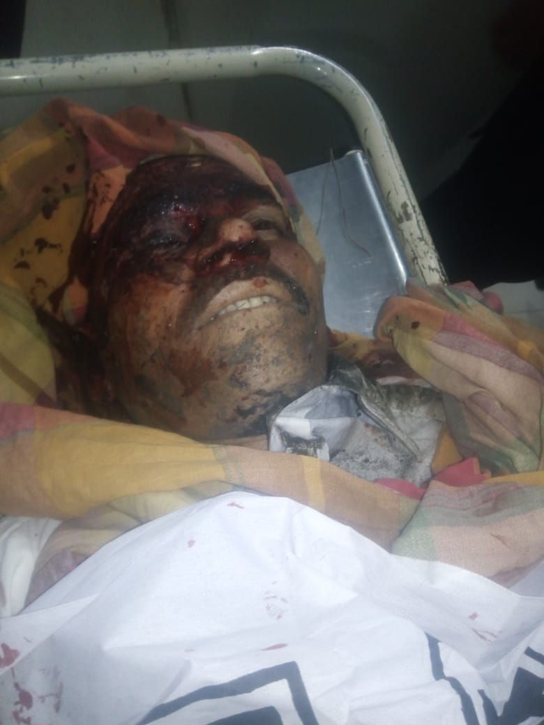 The rickshaw driver Shah Khan jan killed was murdered from two unknown persons firing, hospital moved