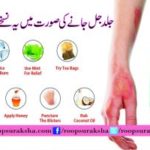Try this prescription as soon as possible